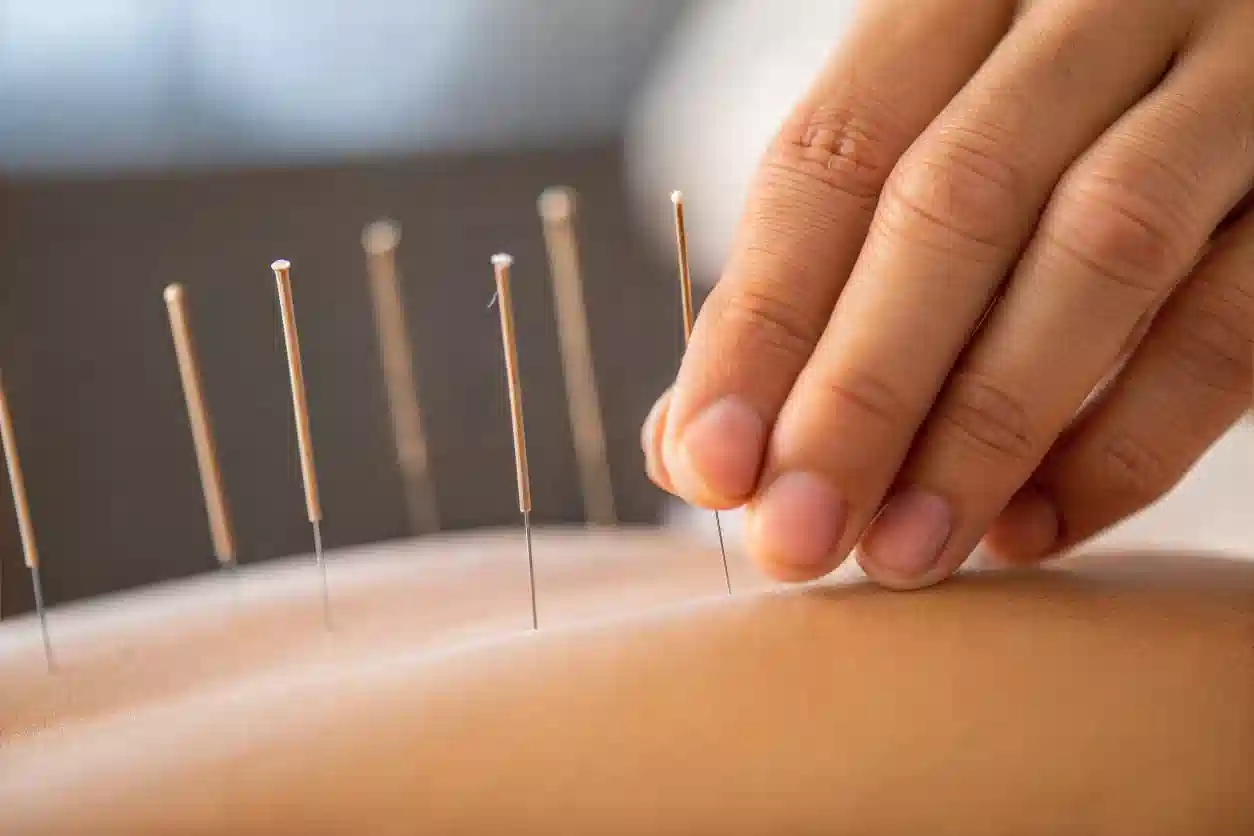 Physiotherapy